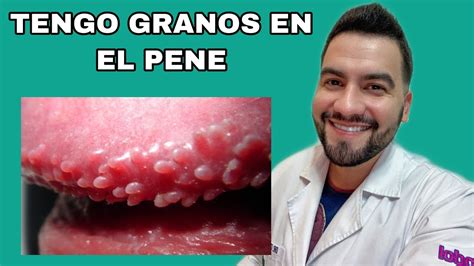 granos en la punta del pene|Heridas en el pene: 14 causas y qué hacer (con fotos)